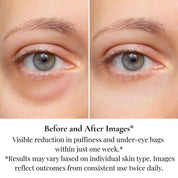 Anti-aging complete eye contour set - brightening eye set