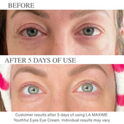 Best Eye Cream for Wrinkles & Dark Circles Over 50 | Youthful Eyes™ – LA MAXIME