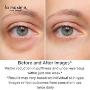 Youthful Eyes Anti-Wrinkle Organic Eye Cream : Dermatologist tested, clinically proven