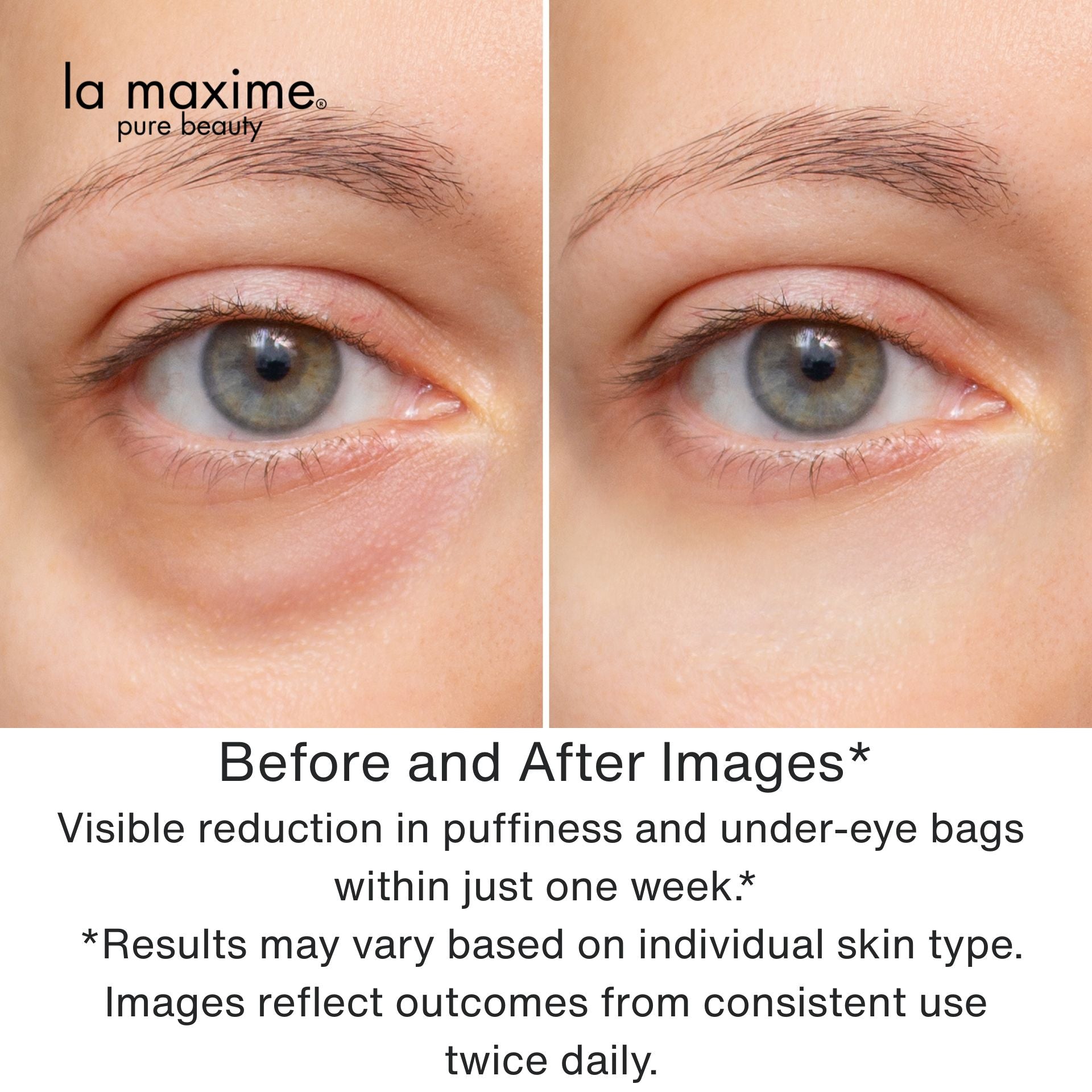 Youthful Eyes Anti-Wrinkle Organic Eye Cream : Dermatologist tested, clinically proven