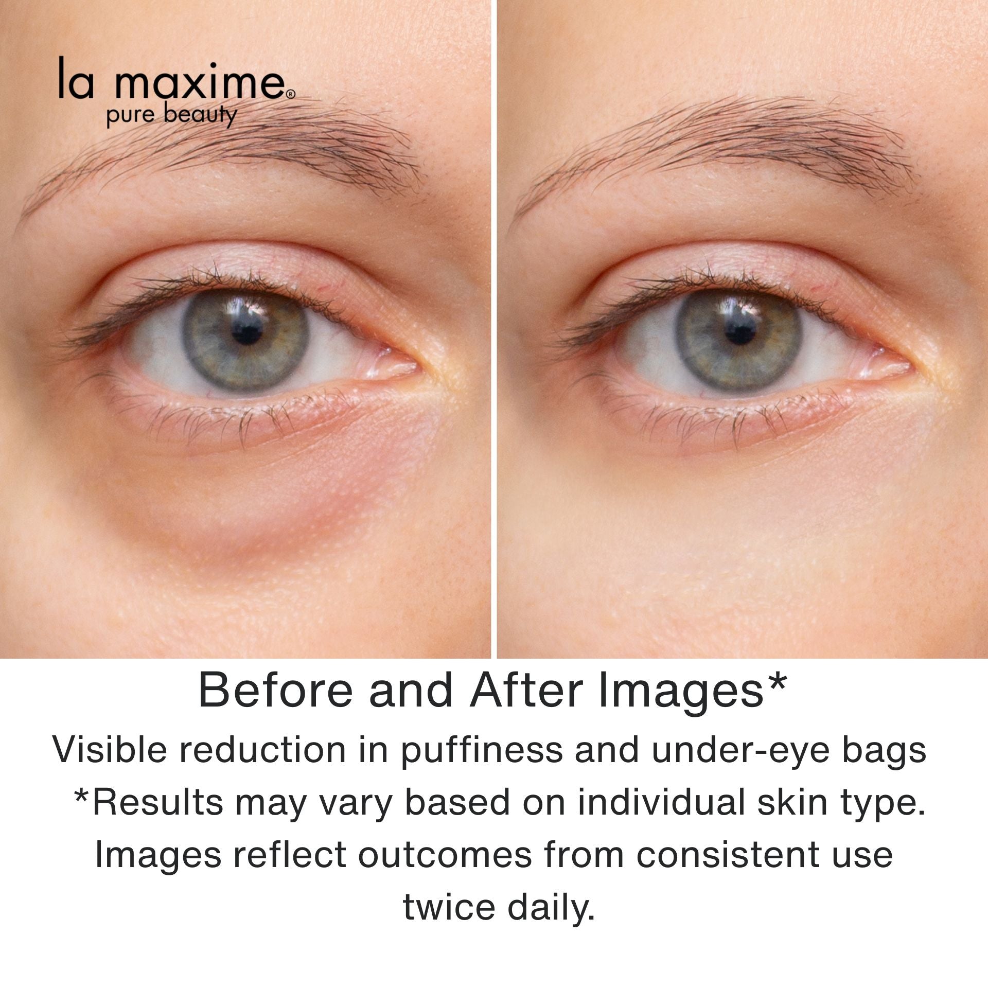 Youthful Eyes Anti-Wrinkle Organic Eye Cream : Dermatologist tested, clinically proven