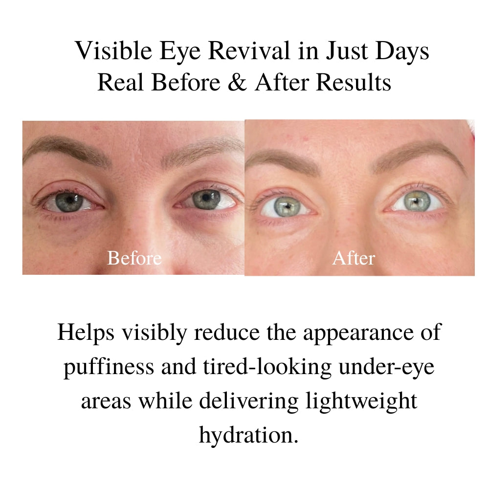 Best Eye Cream for Wrinkles & Dark Circles Over 50 | Youthful Eyes™ – LA MAXIME