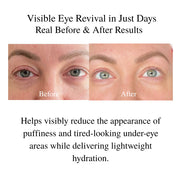 Best Eye Cream for Wrinkles & Dark Circles Over 50 | Youthful Eyes™ – LA MAXIME