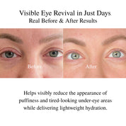 Youthful Eyes Organic Anti-Wrinkle Eye Cream