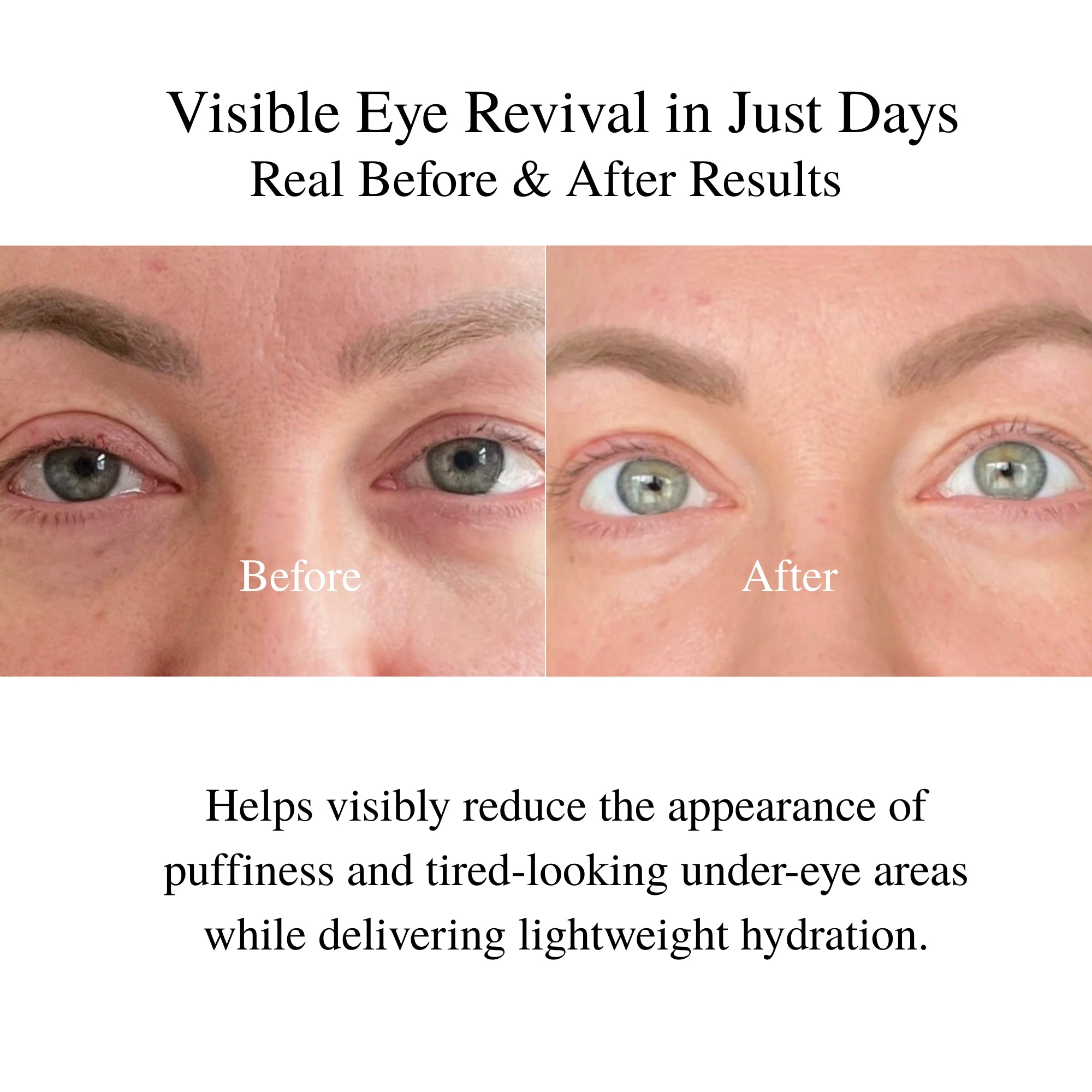 Youthful Eyes Organic Anti-Wrinkle Eye Cream