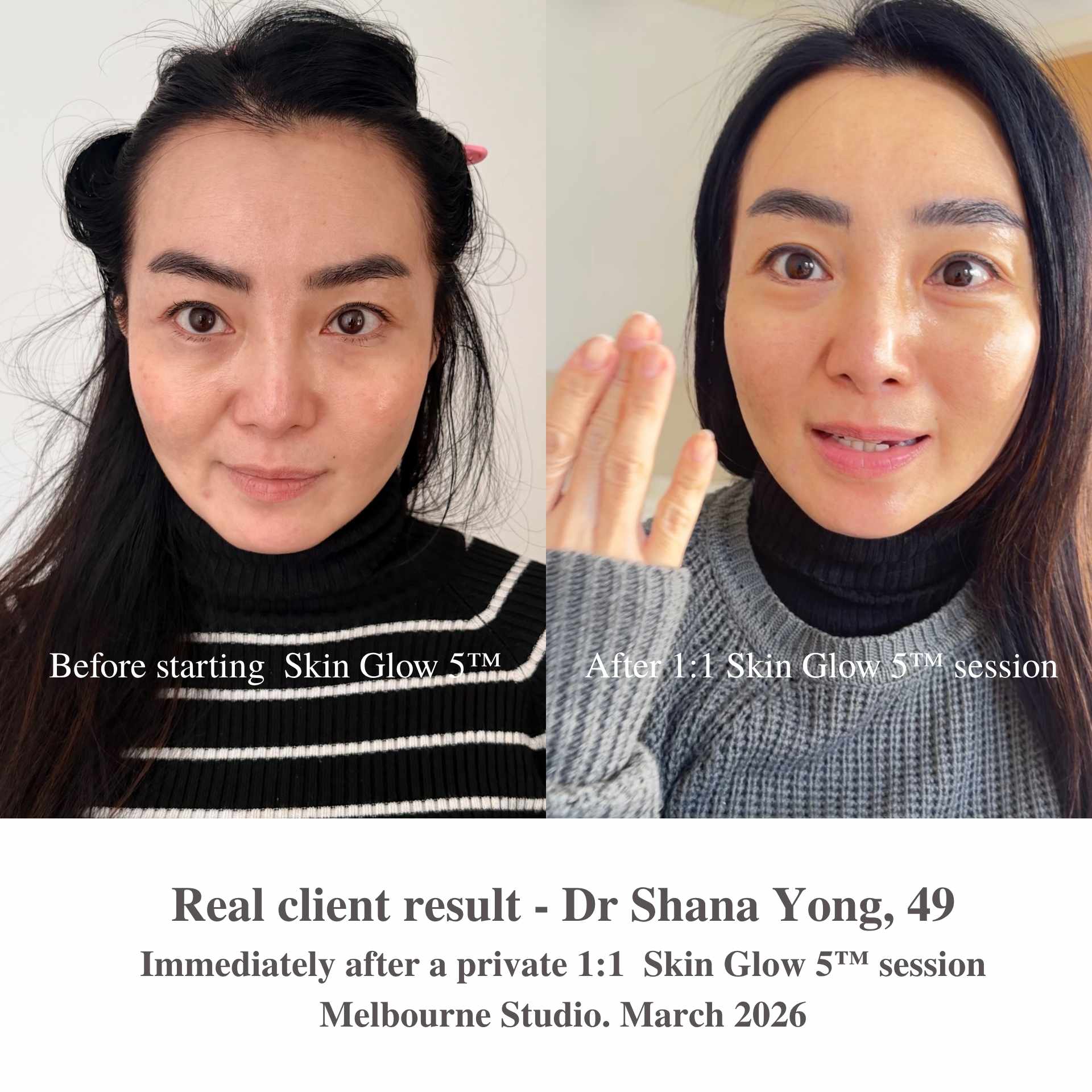 Skincare Routine for Mature Skin Over 50 | Skin Glow 5™ Ritual Set